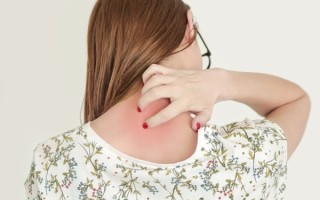 湿疹怎么治？这些方法反复验证真有效【湿疹怎么治好啊】